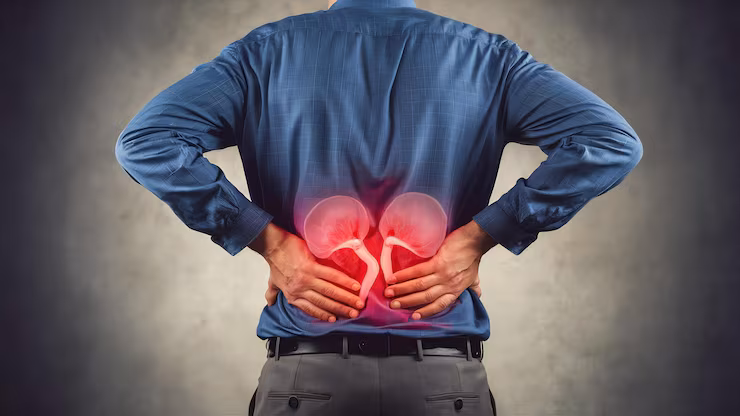 Kidney Disorders Management consultation in Vidyaranyapura Bangalore